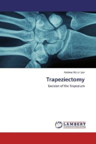Książka Trapeziectomy Krishna Mohan Iyer