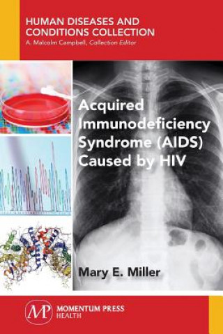 Книга Acquired Immunodeficiency Syndrome (AIDS) Caused by HIV Mary E. Miller