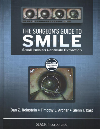 Könyv Surgeon's Guide to SMILE Dan Z Reinstein