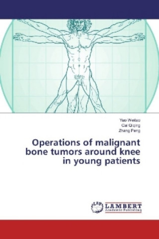 Kniha Operations of malignant bone tumors around knee in young patients Yao Weitao