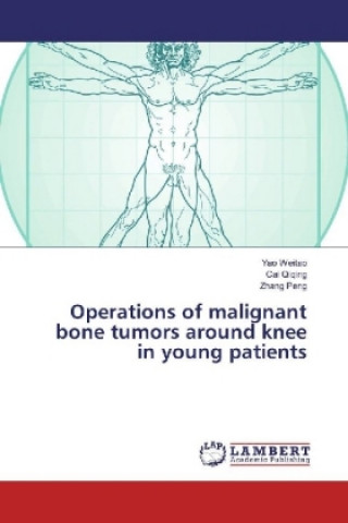 Könyv Operations of malignant bone tumors around knee in young patients Yao Weitao