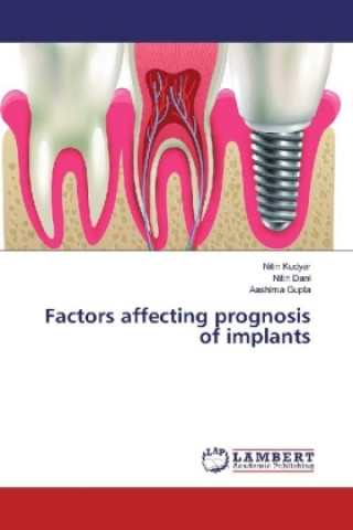 Kniha Factors affecting prognosis of implants Nitin Kudyar