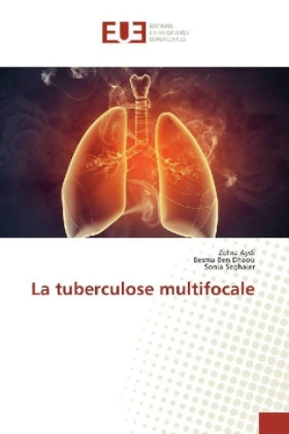 Knjiga La tuberculose multifocale Zohra Aydi