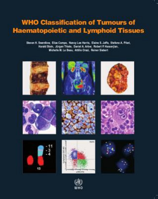 Knjiga WHO classification of tumours of haematopoietic and lymphoid tissues S. Swerdlow