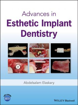 Carte Advances in Esthetic Implant Dentistry Abdelsalam Elaskary