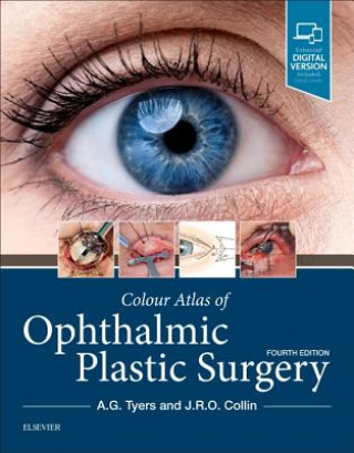 Kniha Colour Atlas of Ophthalmic Plastic Surgery A.G. Tyers