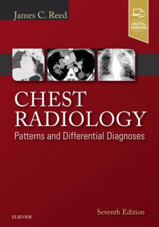 Книга Chest Radiology James C. Reed