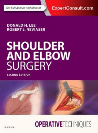 Książka Operative Techniques: Shoulder and Elbow Surgery Neviaser