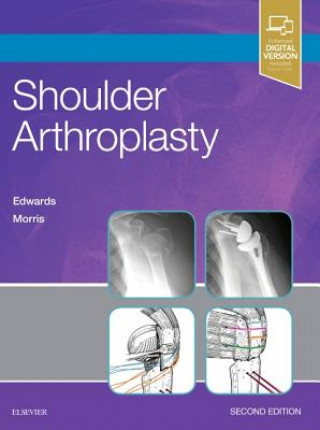 Kniha Shoulder Arthroplasty T. Bradley Edwards