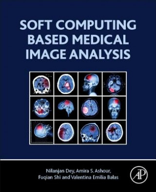 Kniha Soft Computing Based Medical Image Analysis Nilanjan Dey