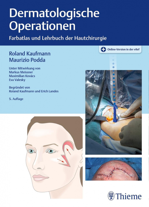 Kniha Dermatologische Operationen Roland Kaufmann