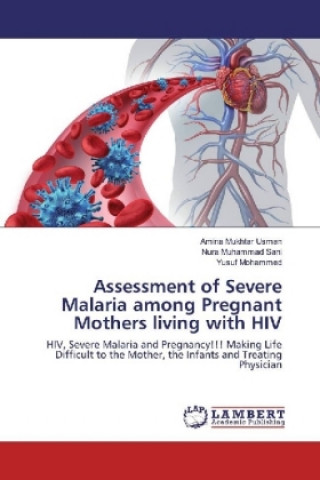 Книга Assessment of Severe Malaria among Pregnant Mothers living with HIV Amina Mukhtar Usman
