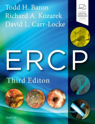 Kniha ERCP Todd H. Baron
