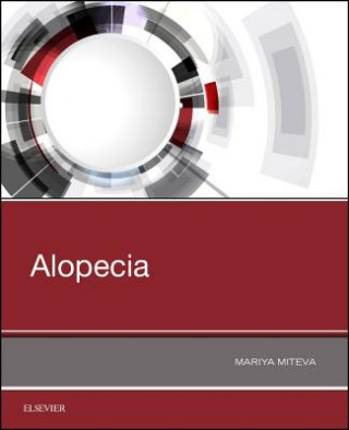 Könyv Alopecia Mariya I Miteva