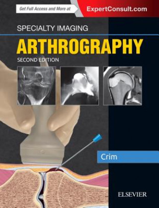 Könyv Specialty Imaging: Arthrography Crim
