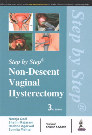 Kniha Step by Step: Non-Descent Vaginal Hysterectomy Neerja Goel
