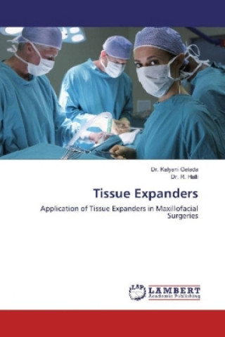 Knjiga Tissue Expanders Kalyani Gelada