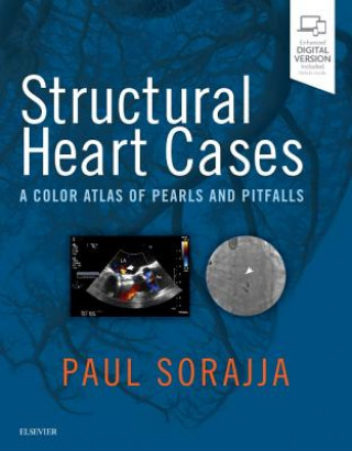 Książka Structural Heart Cases Paul Sorajja