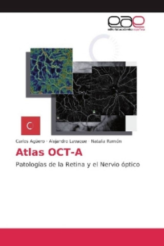 Kniha Atlas OCT-A Carlos Agüero