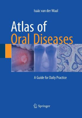 Kniha Atlas of Oral Diseases Isaac Van Der Waal