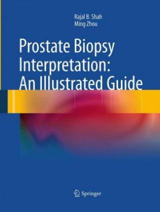 Carte Prostate Biopsy Interpretation: An Illustrated Guide Rajal B. Shah