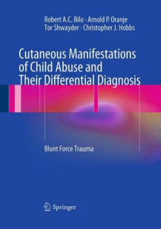 Книга Cutaneous Manifestations of Child Abuse and Their Differential Diagnosis Robert A.C. Bilo