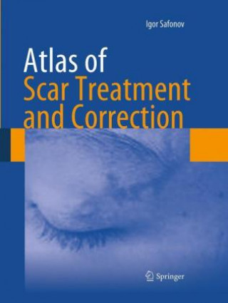 Carte Atlas of Scar Treatment and Correction Igor Safonov