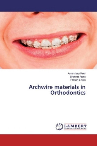 Book Archwire materials in Orthodontics Amandeep Kaur