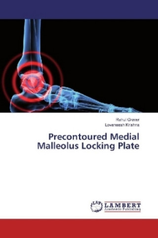 Kniha Precontoured Medial Malleolus Locking Plate Rahul Grover