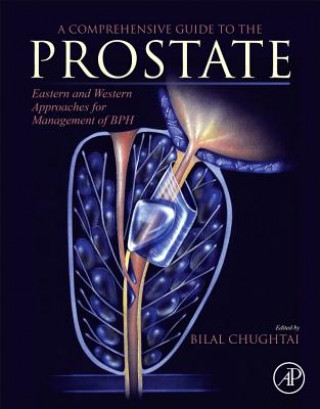 Carte Comprehensive Guide to the Prostate Bilal Chughtai