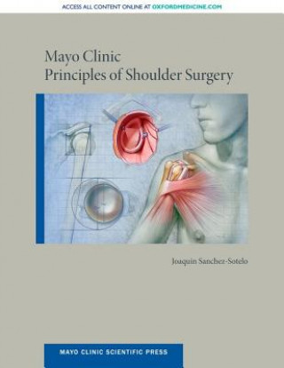 Carte Mayo Clinic Principles of Shoulder Surgery Sanchez-Sotelo