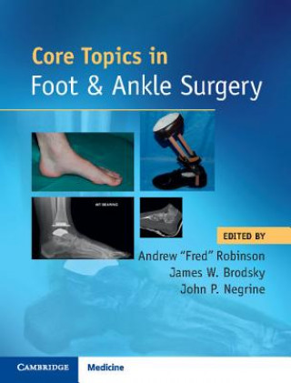 Kniha Core Topics in Foot and Ankle Surgery Andrew Robinson