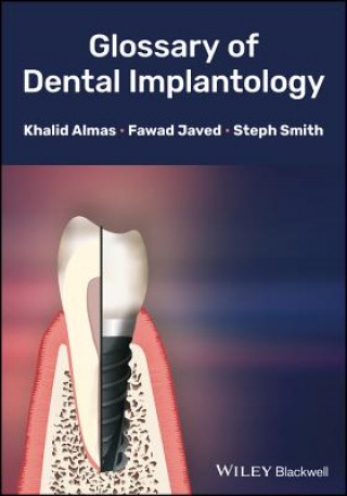 Knjiga Glossary of Dental Implantology Almas