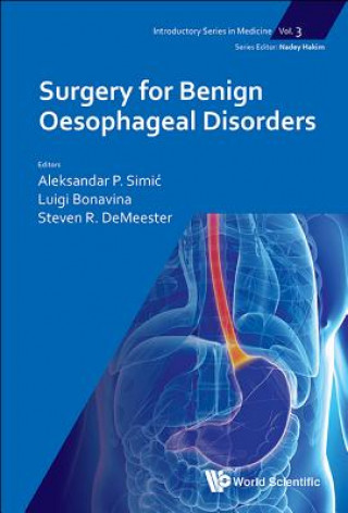 Kniha Surgery For Benign Oesophageal Disorders Luigi Bonavina