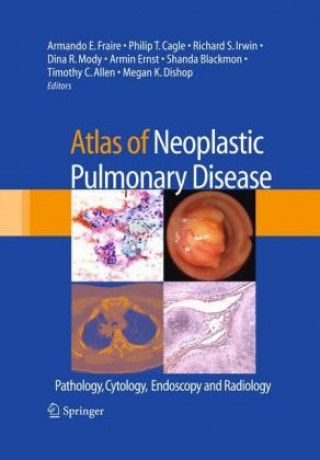 Kniha Atlas of Neoplastic Pulmonary Disease Armando E. Fraire