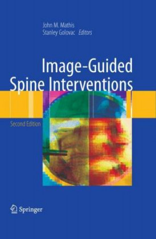 Kniha Image-Guided Spine Interventions John M. Mathis