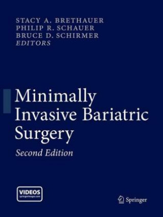 Kniha Minimally Invasive Bariatric Surgery Stacy A. Brethauer