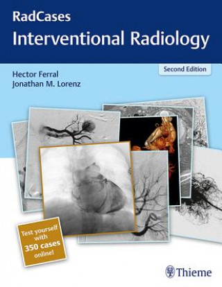 Książka RadCases Q&A Interventional Radiology Hector Ferral