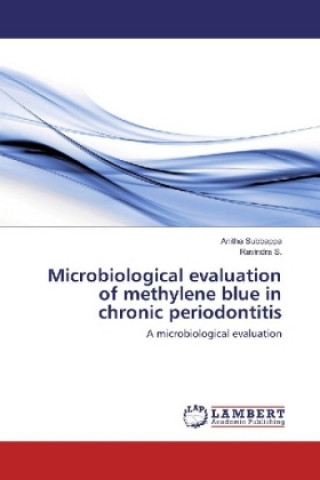 Kniha Microbiological evaluation of methylene blue in chronic periodontitis Anitha Subbappa