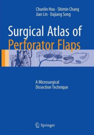 Kniha Surgical Atlas of Perforator Flaps Chunlin Hou