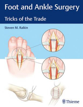 Kniha Foot and Ankle Surgery Steven Raikin