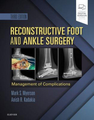 Buch Reconstructive Foot and Ankle Surgery: Management of Complications Myerson