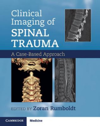 Könyv Clinical Imaging of Spinal Trauma Zoran Rumboldt