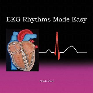 Knjiga EKG Rhythms Made Easy Alberto Yanez