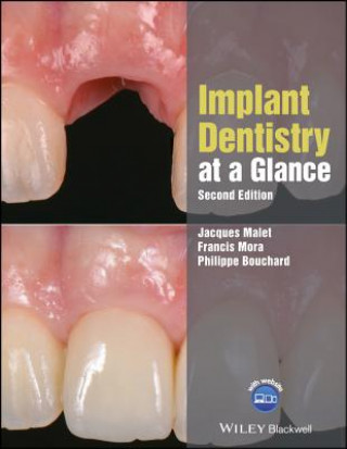 Kniha Implant Dentistry at a Glance, 2nd Edition Jacques Malet