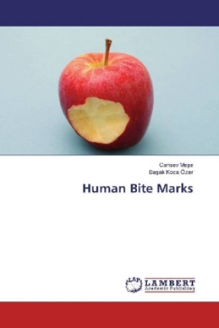 Knjiga Human Bite Marks Cansev Mese