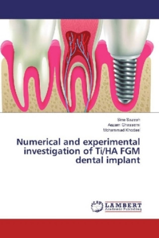 Livre Numerical and experimental investigation of Ti/HA FGM dental implant Sina Sazesh