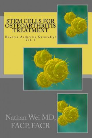 Carte Stem Cells for Osteoarthritis Treatment: An easy to understand "consumer's guide" to understanding how stem cells are used to treat osteoarthritis. Facp Facr Nathan Wei MD