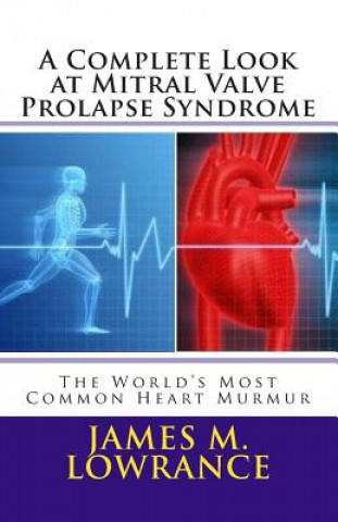 Książka A Complete Look at Mitral Valve Prolapse Syndrome: The World's Most Common Heart Murmur James M Lowrance