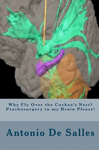 Carte Why Fly Over the Cuckoo's Nest? Psychosurgery in my Brain Please! Antonio De Salles